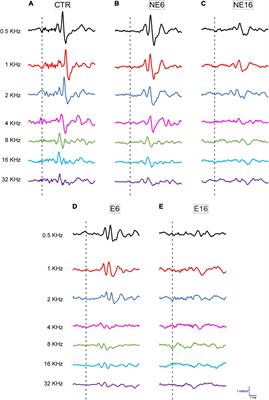 Age-Related Inflammation and Oxidative Stress in the Cochlea Are Exacerbated by Long-Term, Short-Duration Noise Stimulation